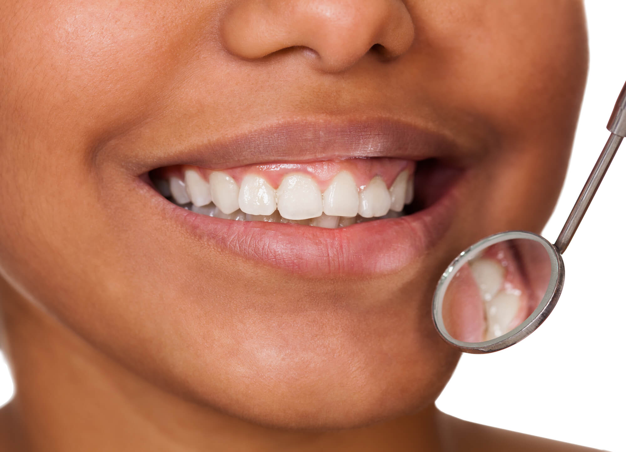 woman after getting Cosmetic dentistry in Hells kitchen