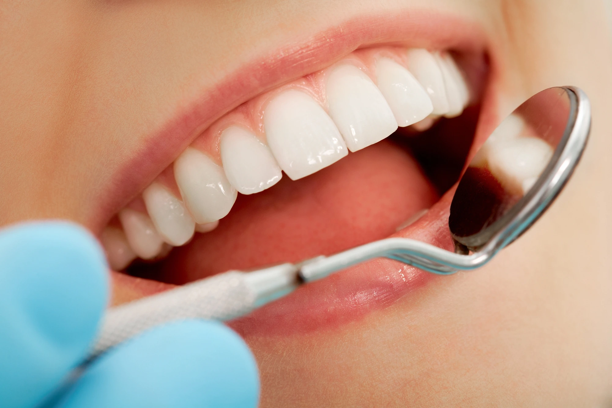 close-up-of-mouth-being-inspected-during-cosmetic-dentistry-in-Murray-Hill