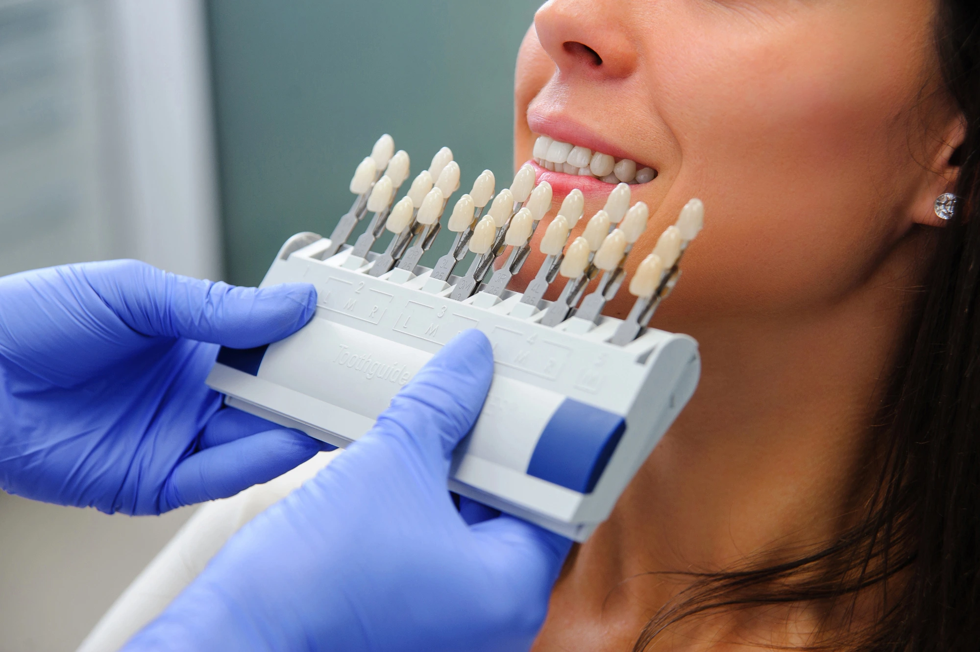 dentist showing patient Same day Crowns in Murray Hill