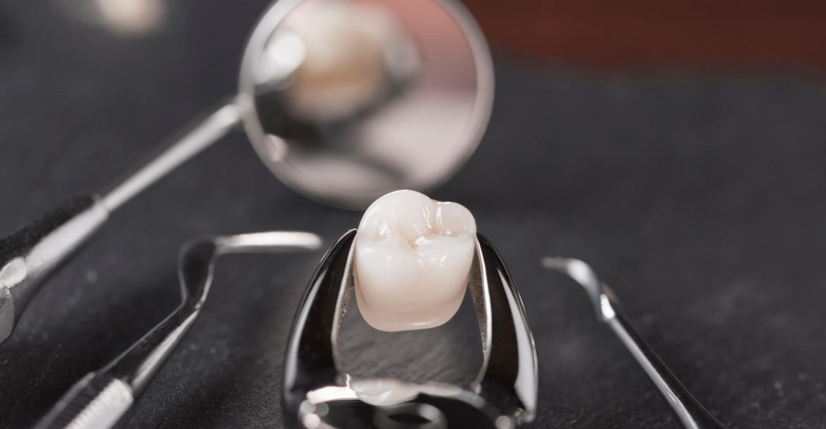 Dentist Murray hill Holding a Dental Tool
