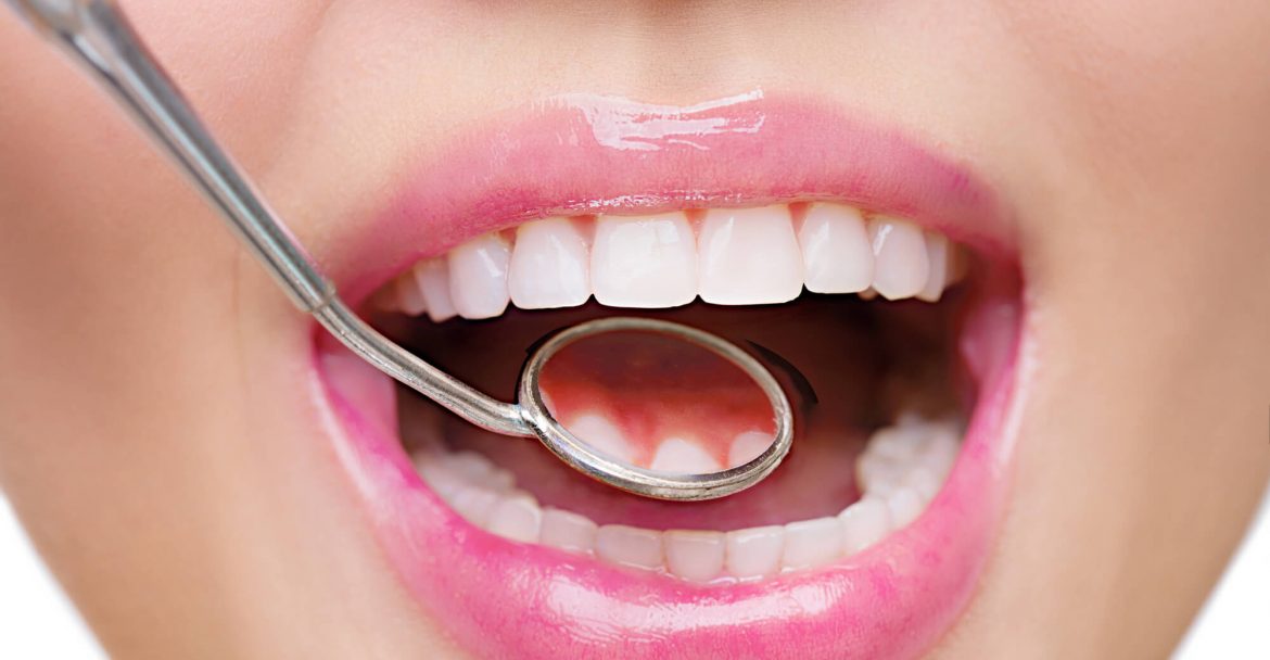 Patient after gum bleaching procedure Gramercy park