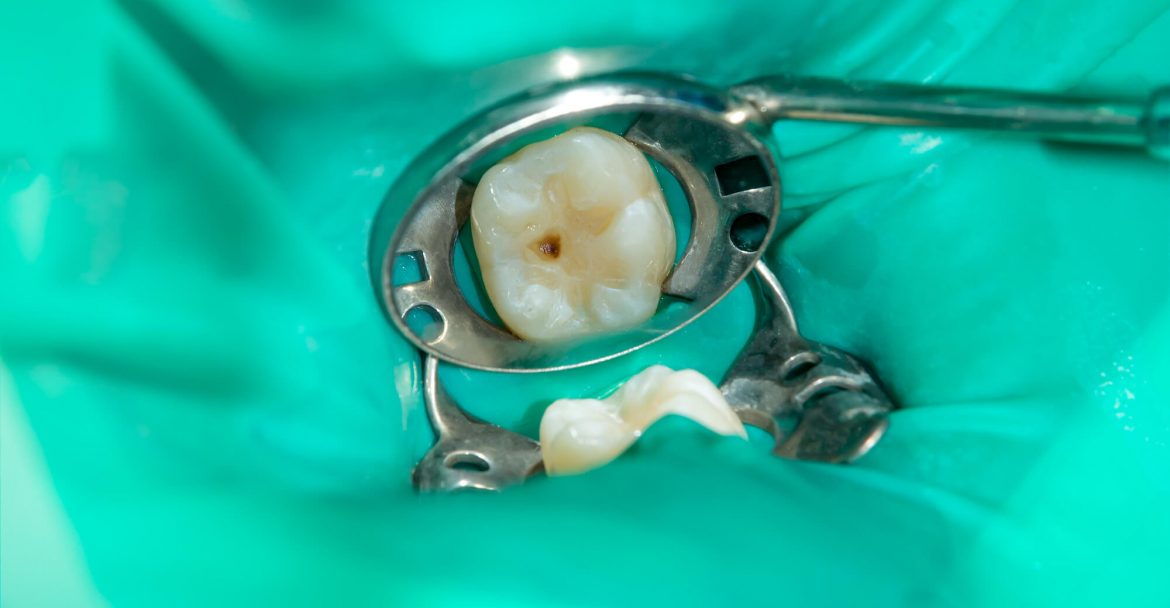 Illustration of Restorative dentistry in midtown Manhattan