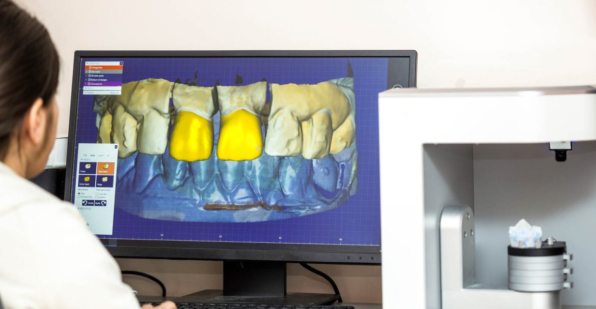 Person working on computer with dental software platform for make dental prosthesis. Dental prosthesis manufacturing process using dedicated software.