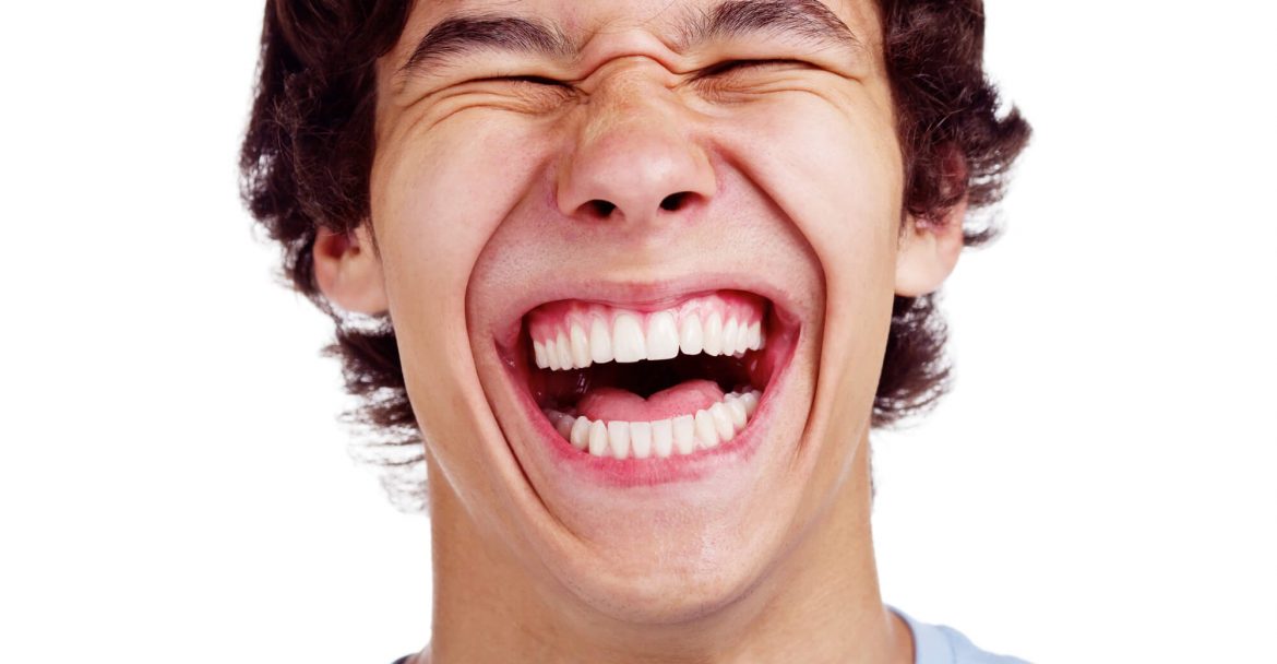 a young man grins after Gum Bleaching in Gramercy Park