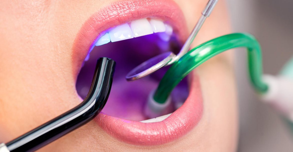 Doctor performing Laser Dentistry in midtown Manhattan on a patient 