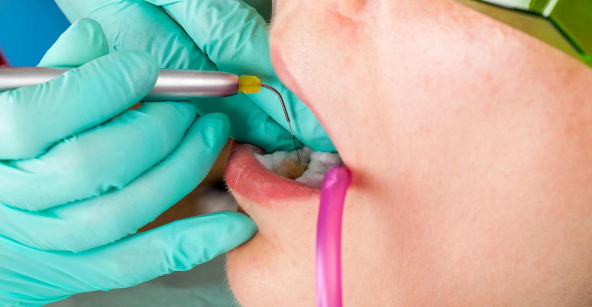 Kid undergoing laser dentistry procedure in murray hill