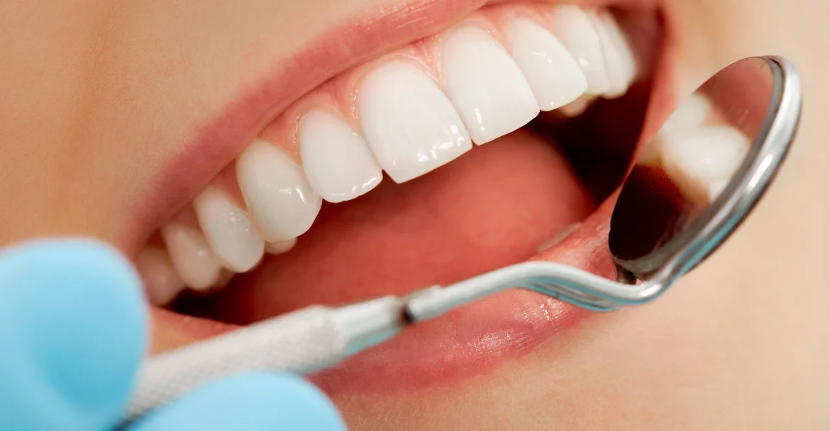close-up-of-mouth-being-inspected-during-cosmetic-dentistry-in-Murray-Hill