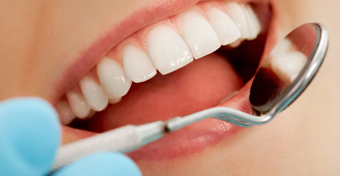 close-up-of-mouth-being-inspected-during-cosmetic-dentistry-in-Murray-Hill