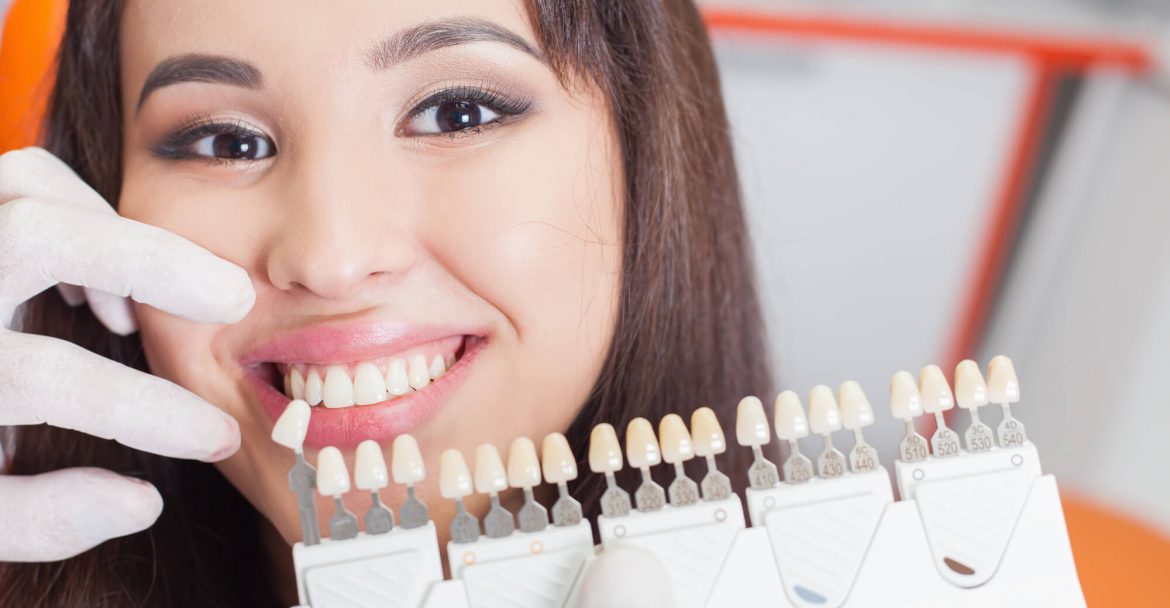 patient choosing a shade for her Same day Crowns midtown Manhattan